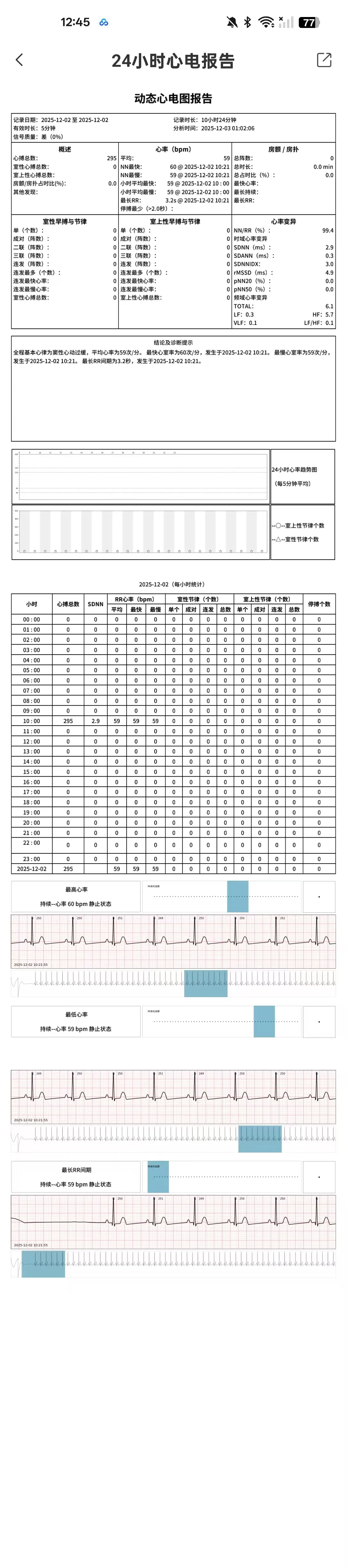 Holter 24-Hour Dynamic ECG Monitoring Complete Heart Health Report